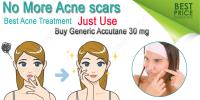 Buy Generic Accutane 30 mg image 2