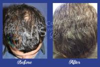 Dr. VJs Hair Transplantation Centre image 1