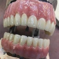 Abutment Dental Paterson image 1