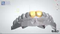 Abutment Dental Paterson image 2