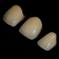 Dental Crowns Lab image 2