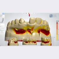 Dental Crowns Lab image 3