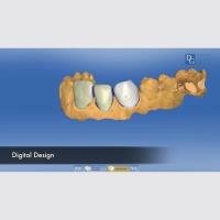 Dental Crowns Lab image 4