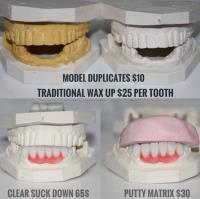 Dental Crowns Lab Trenton image 5