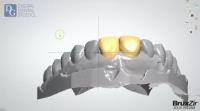 Dental Crowns Lab Trenton image 4