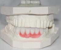 Dental Crowns Lab Trenton image 3