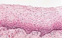 Corneal Angiogenesis Assay image 1