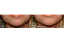 Facial Plastic Surgery Institute image 5