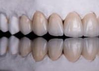 Full Service Dental Lab image 7