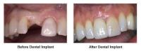 USPARKLE Family & Cosmetic Dentistry image 4