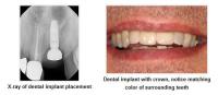 USPARKLE Family & Cosmetic Dentistry image 3