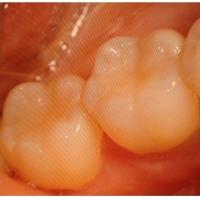 Peyton Dental & Orthodontics image 2