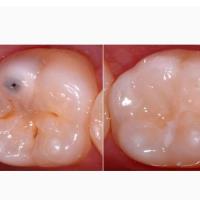 Peyton Dental & Orthodontics image 3