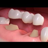 Peyton Dental & Orthodontics image 4