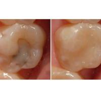 Peyton Dental & Orthodontics image 5