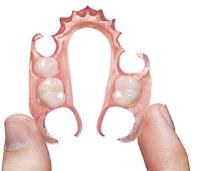 Partial Dentures Albany image 2