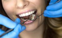 Affordable Dental Implants Albany image 3