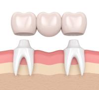 Ayoub Dental Corp image 3