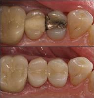 Maryland Sedation Dentist image 2
