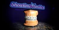 Showtime Smiles Orthodontics & Pediatric Dentistry image 6