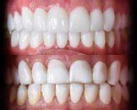 Dental Crowns Lab Woodbridge image 4