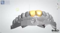 Dental Crowns Lab Woodbridge image 5