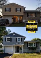 Above & Beyond Exterior Remodelers image 3