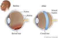 Texoma Retina Center (Vijay Khetpal MD) image 4
