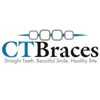 CT Braces image 1