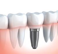 Select Dental Care image 2