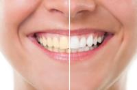 Ocean Smiles Family Dentistry image 1