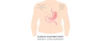 Gastric Bypass Surgery image 4
