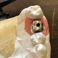 Modern Restorative Dental Lab image 2