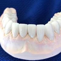 Modern Restorative Dental Lab image 4