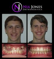 Nia Jones Orthodontics image 10