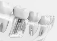 Worcester Dental Associates image 9