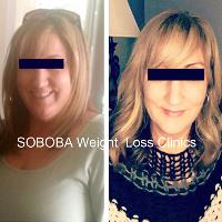 Soboba Weight Loss Newport Beach image 1