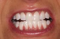 Kruyer Dental image 3