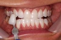 Kruyer Dental image 5