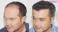 Medispa Hair Transplant Clinic image 1