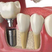 ROOT Periodontal & Implant Center - Frisco image 3