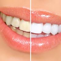 Superior Cosmetic & Family Dentistry image 8