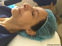 San Diego Cosmetic Laser Clinic image 6