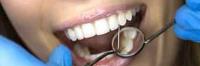 Tooth Filling image 4