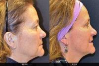 Ladner Facial Plastic Surgery image 2