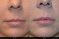 Ladner Facial Plastic Surgery image 4