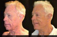 Ladner Facial Plastic Surgery image 5