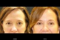 Ladner Facial Plastic Surgery image 6