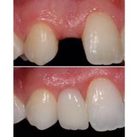The Dental Method Richardson image 4