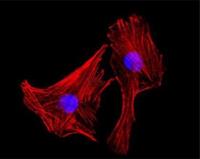 actinomyces naeslundii image 1